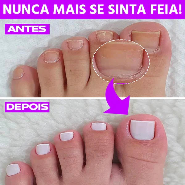 Lixa De Unha Elétrica Profissional 5 Em 1 Sem Fio ⭐⭐⭐⭐⭐